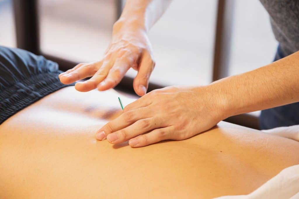 Lucus Leung applying dry needling to treat muscle pain and trigger points during a physiotherapy session